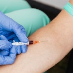 Esami del sangue per la donna: cosa controllare e quando farli per sentirsi al meglio
