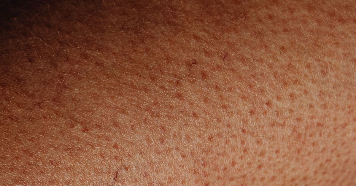 Rossore e fastidio nella zona inguinale: cause comuni e rimedi delicati per ritrovare comfort