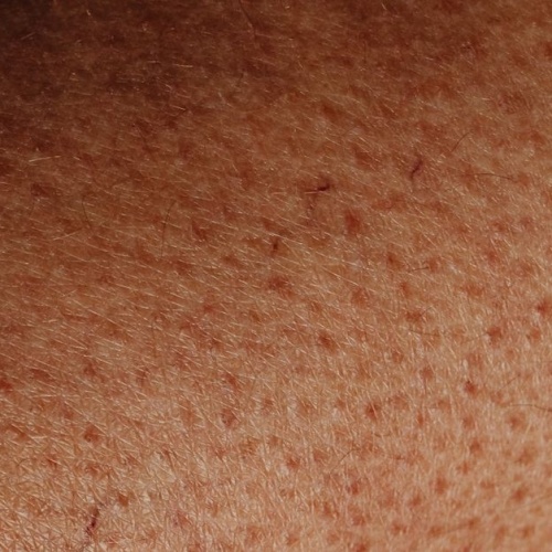 Rossore e fastidio nella zona inguinale: cause comuni e rimedi delicati per ritrovare comfort