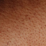 Rossore e fastidio nella zona inguinale: cause comuni e rimedi delicati per ritrovare comfort