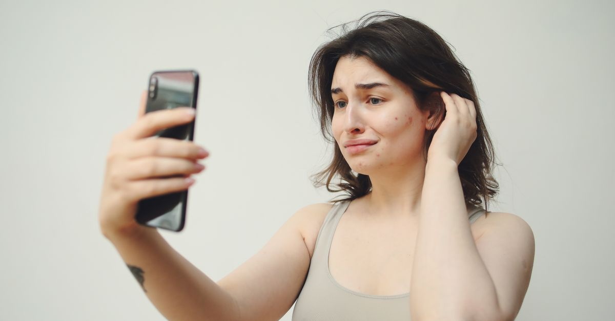 Acne e Ovaio Policistico: Cause Nascoste e Strategie Efficaci per Ritrovare una Pelle Serena