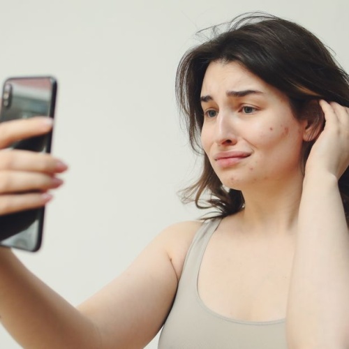 Acne e Ovaio Policistico: Cause Nascoste e Strategie Efficaci per Ritrovare una Pelle Serena